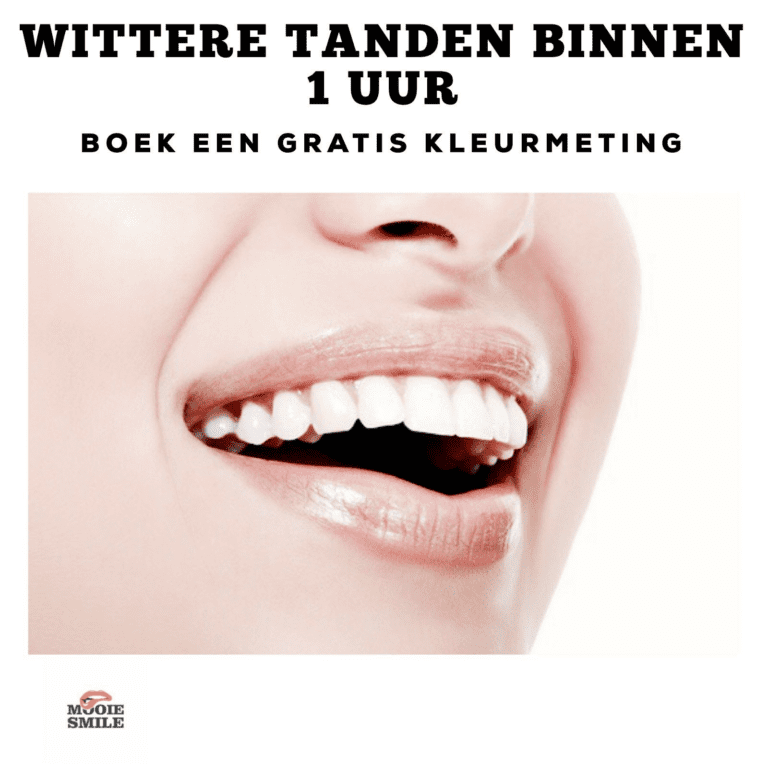 tandenblekenzoetermeer